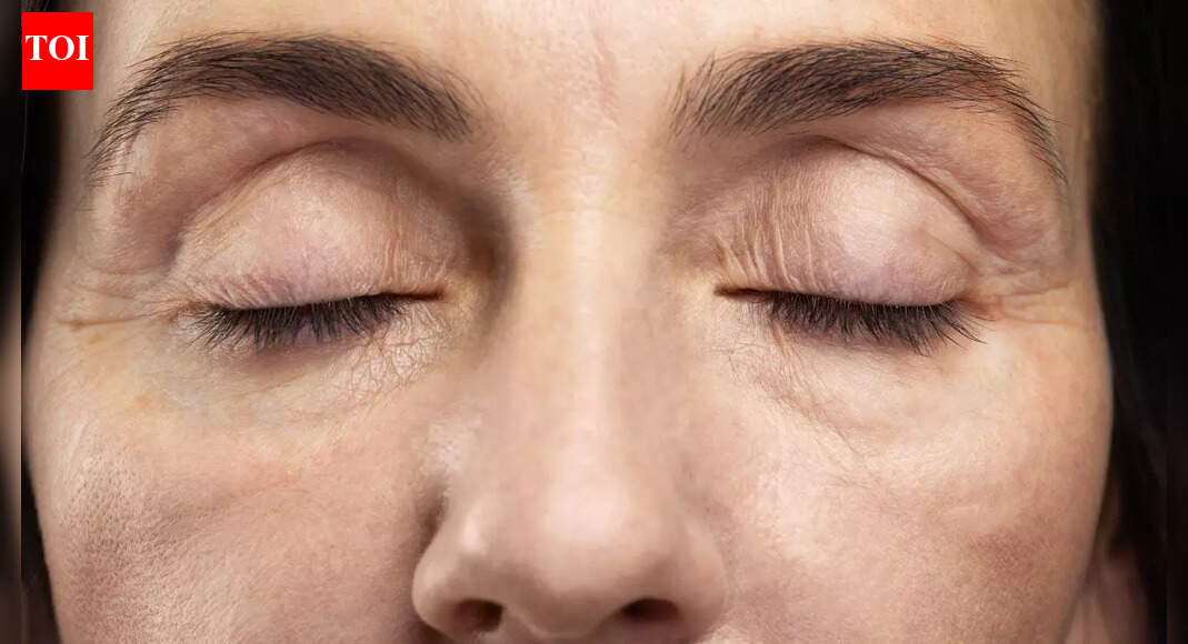 What your eyelashes say about your overall health: 4 conditions you should never ignore |