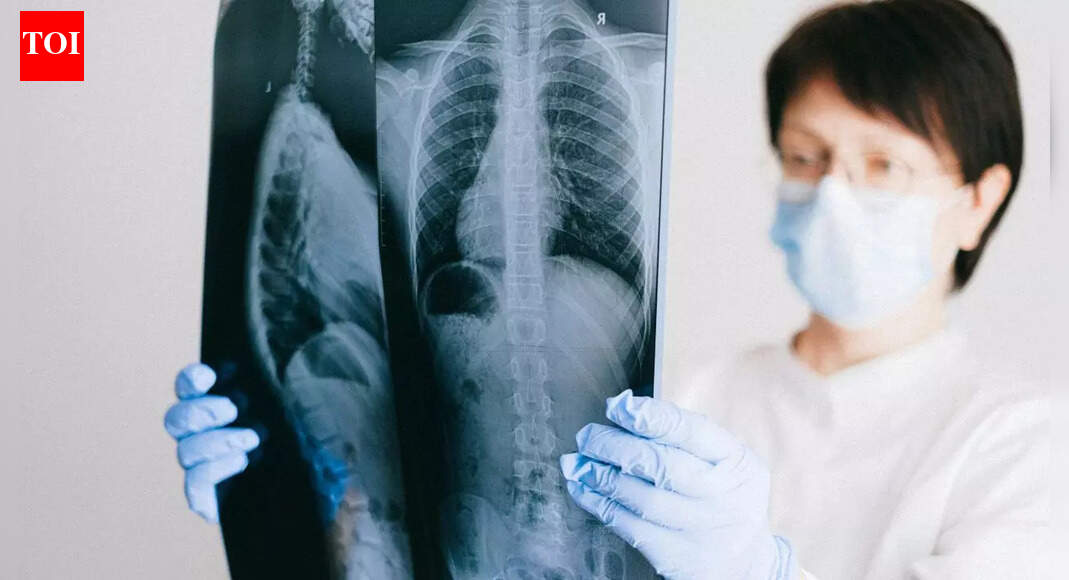 8 subtle signs of lung disease you need to recognise that go beyond cough |