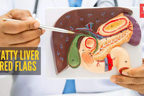 Fatty Liver Symptoms: Harvard-trained doctor lists warning signs of fatty liver that one should never miss |
