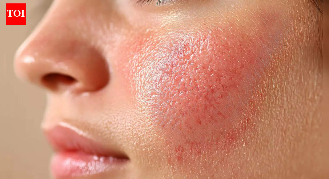 5 skin signs of liver damage you should not ignore |