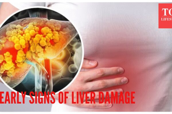 Early signs of liver damage that can be seen on the hands and feet