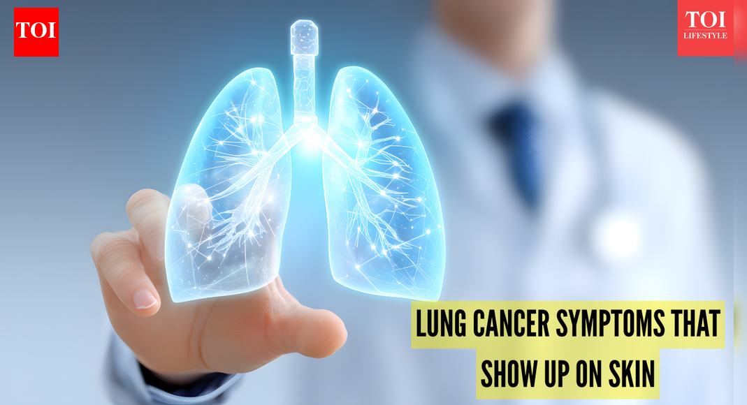 5 unexpected skin symptoms that could signal c