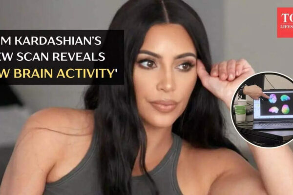 Kim Kardashian’s new scan reveals ‘low brain activity’ after aneurysm diagnosis: What that means |