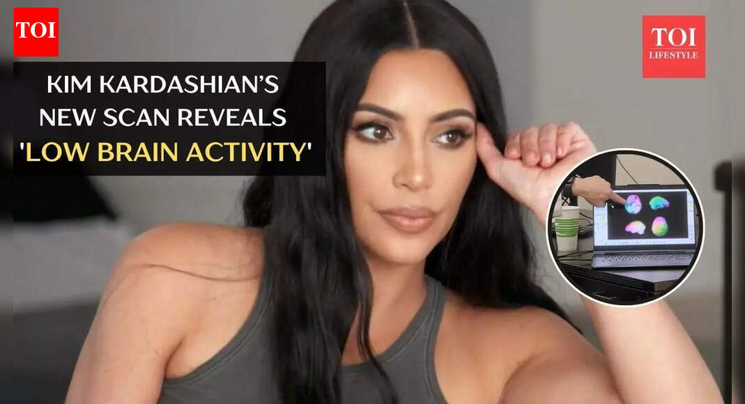 Kim Kardashian’s new scan reveals ‘low brain activity’ after aneurysm diagnosis: What that means |
