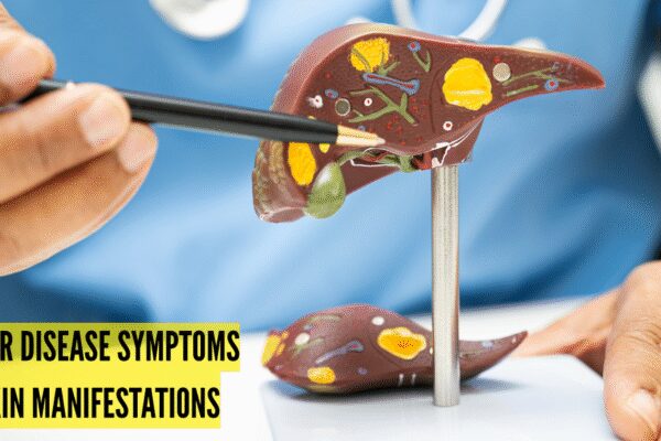 4 prominent liver damage warning symptoms that show on skin