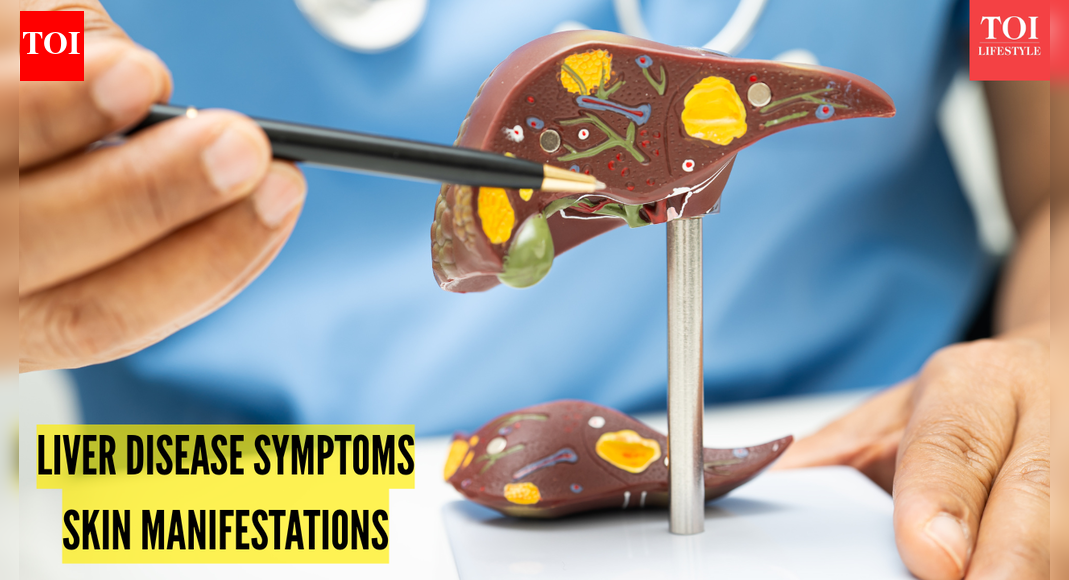 4 prominent liver damage warning symptoms that show on skin