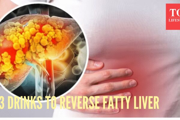 Top Gastroenterologist reveals 3 drinks that can reverse fatty liver, ‘Small, daily habits can genuinely reduce inflammation, improve fat metabolism, and….”