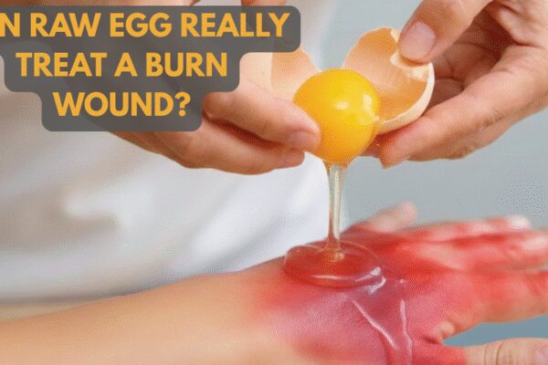 Does egg white really heal burn wounds? Doctors warn of deadly infection risk |