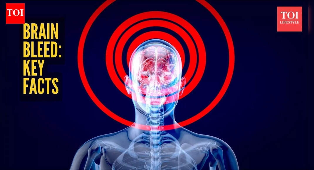 Swara Bhaskar’s father-in-law suffers brain haemorrhage: Understanding the medical condition and its symptoms