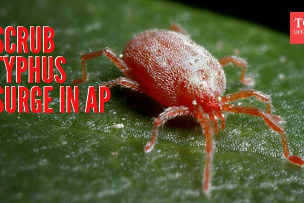 Scrub Typhus Symptoms: Andhra Pradesh reports surge in scrub typhus cases: Understanding its symptoms and how it is a growing threat for India |
