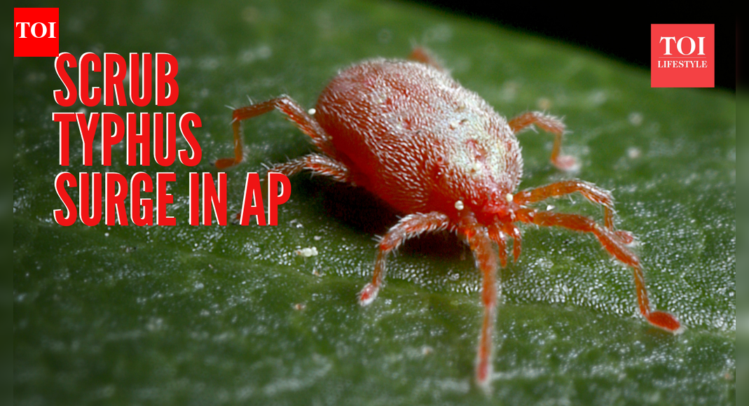 Scrub Typhus Symptoms: Andhra Pradesh reports surge in scrub typhus cases: Understanding its symptoms and how it is a growing threat for India |