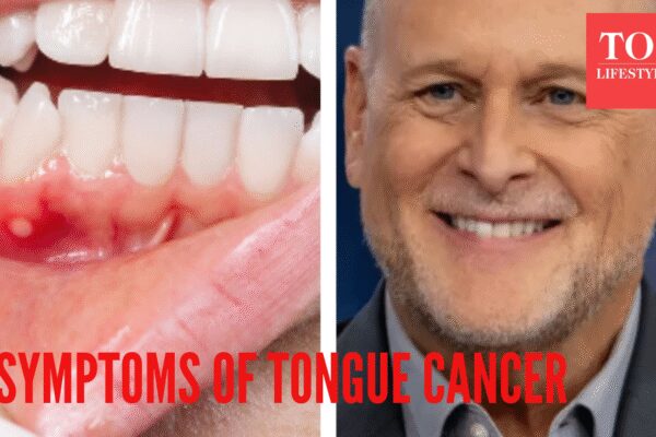 what is the condition, and what are the symptoms