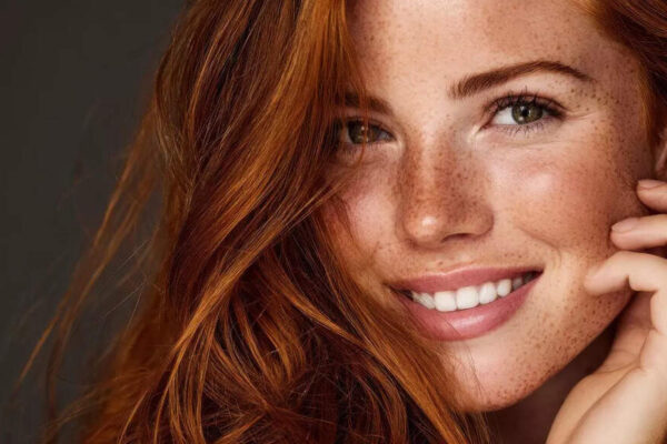 If you have red hair, this shocking new study says your wounds may heal differently |