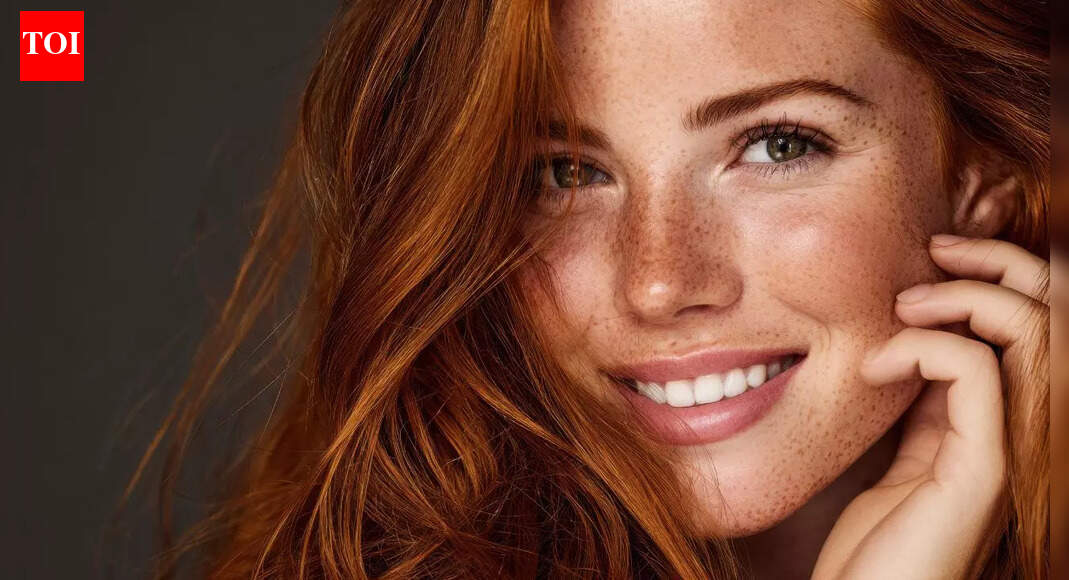 If you have red hair, this shocking new study says your wounds may heal differently |