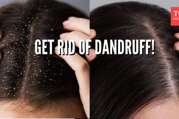 4 home remedies that actually work