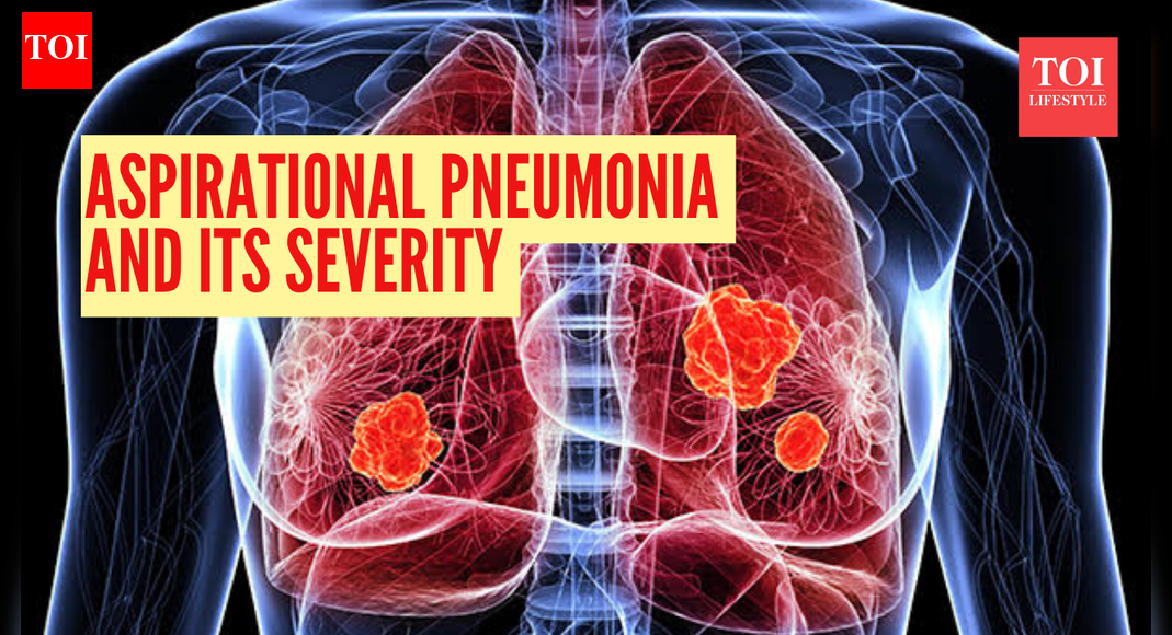 Aspiration pneumonia: Doctor explains how a ‘simple accident’ can lead to this life-threatening condition |