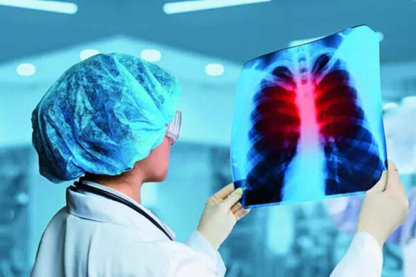 People living near mines showing lung damage