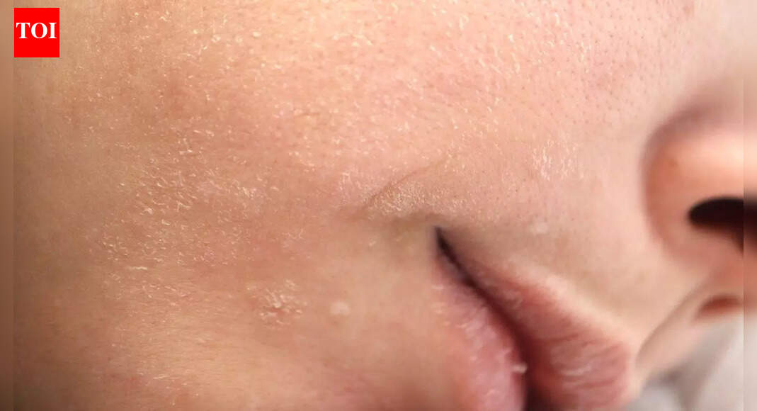 Understanding thyroid disorders: How hypothyroidism and hyperthyroidism impact skin, hair, and nail health |