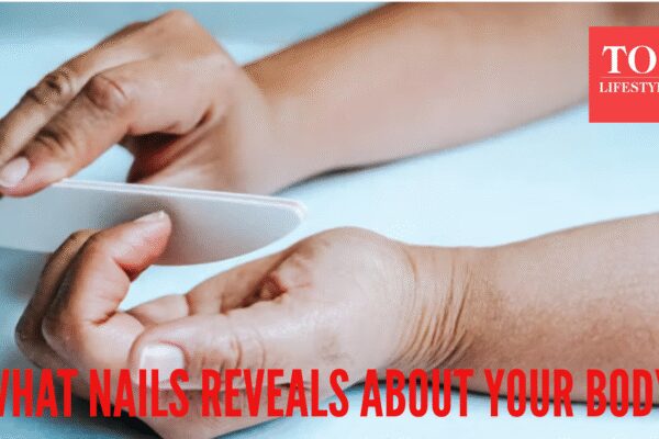 From spoon shaped to white spots: What your nails reveal about deficiencies