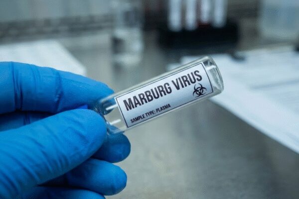Saudi citizens warned as deadly Marburg Virus outbreak hits Southern Ethiopia | World News