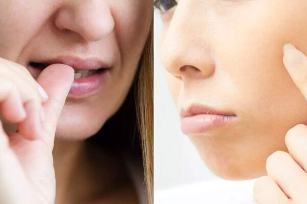 Why you can’t stop picking your skin: Know what really causes it and how you can break the cycle |
