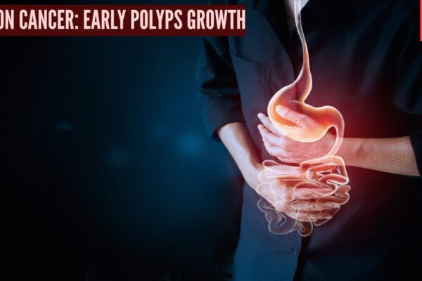 Colon cancer: Doctor explains how early polyps grow quietly and how screening saves lives