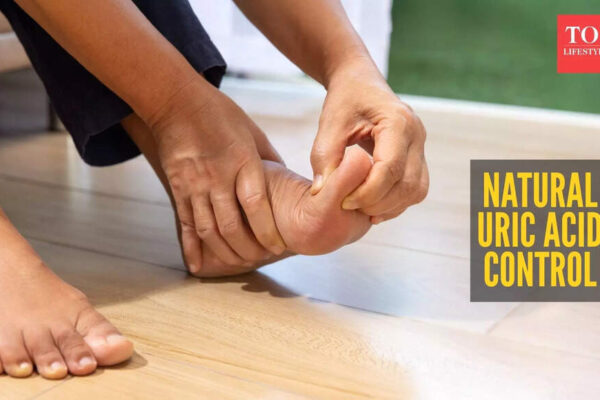 High uric acid level? 10 ways to manage it naturally without any medicine