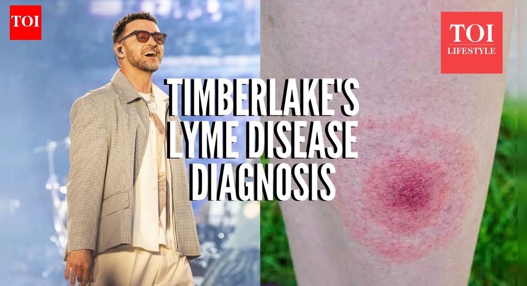 Justin Timberlake’s lyme disease diagnosis: What to know about the tick-borne illness |