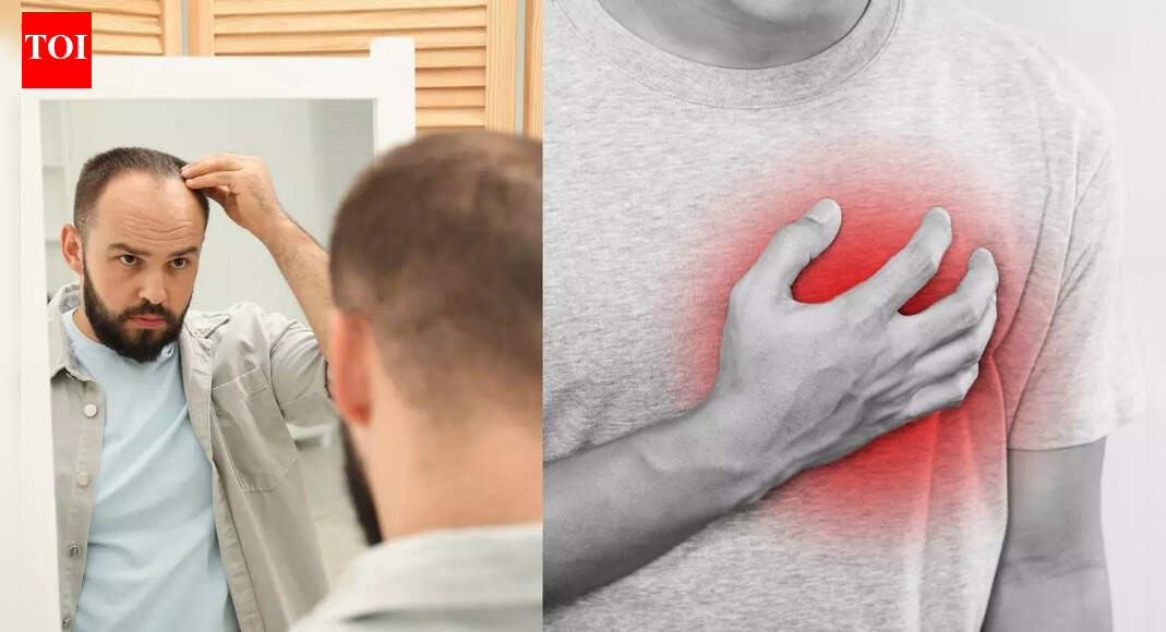 Severe hair loss in men may signal early heart problems: What new research reveals |