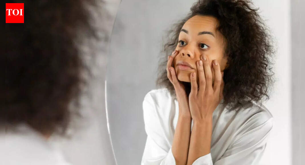 Do your dark circles worsen in winter? The real reasons your eyes look tired |