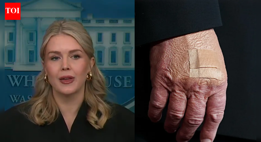 Karoline Leavitt reveals why there are bandages on Trump’s hand: ‘The president is literally…’