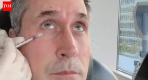 Botox on just one side: Doctor injects half of husband’s face to show ‘shocking’ before-and-after |