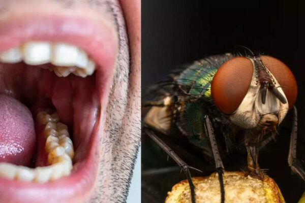 Mouth larvae: How a small fly triggers a dangerous infection; causes, symptoms and treatment explained |