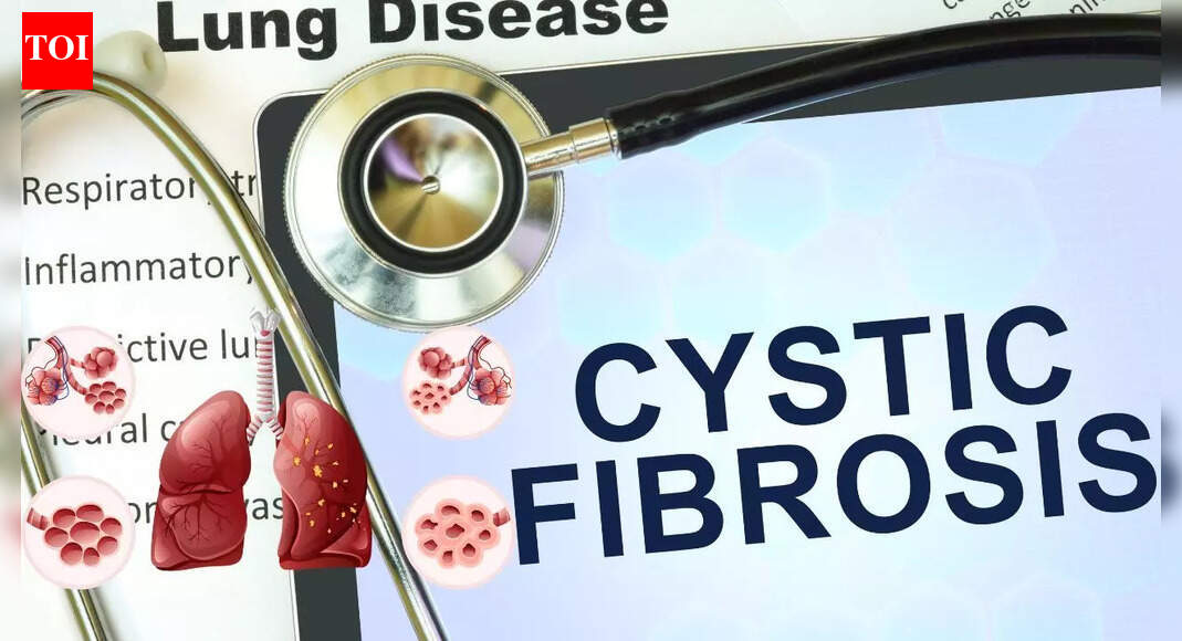 Cystic Fibrosis: Causes, symptoms, diagnosis and modern treatment approaches |