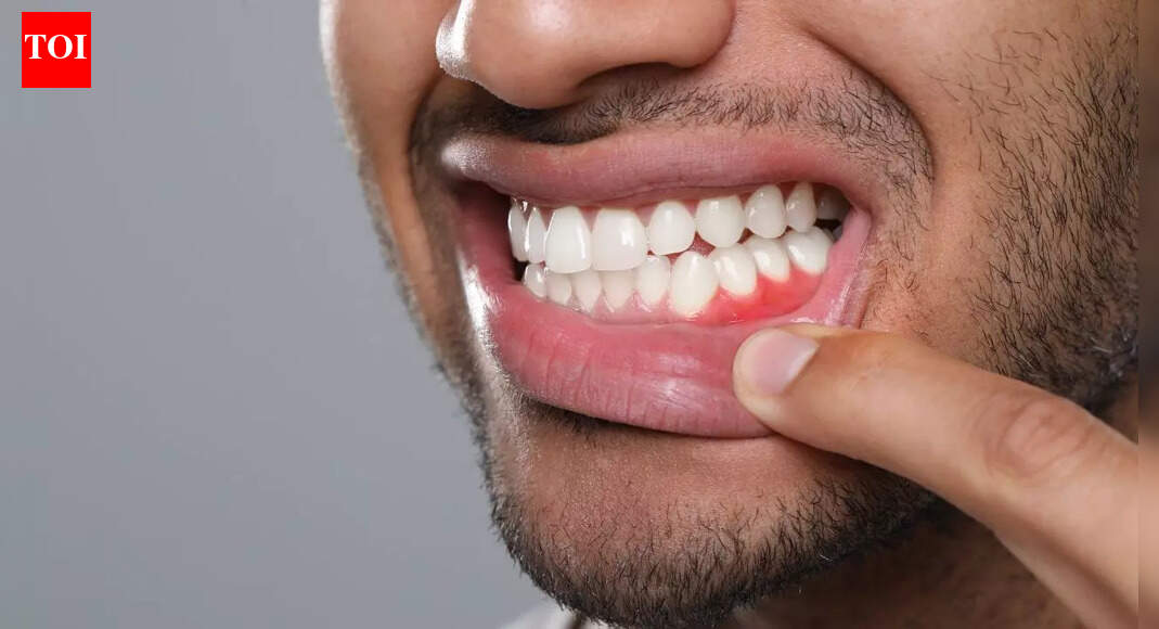 Gum diseases may affect more than teeth: How poor oral health raises stroke risk; key tips to protect oral and brain health |