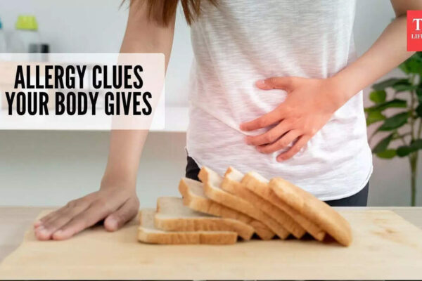 Signs you may have a food allergy and how doctors diagnose it |
