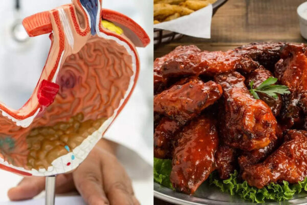 Can eating chicken daily increase gastric cancer risk? Experts explain |
