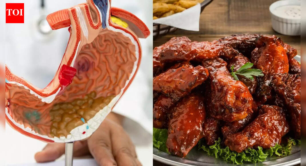 Can eating chicken daily increase gastric cancer risk? Experts explain |