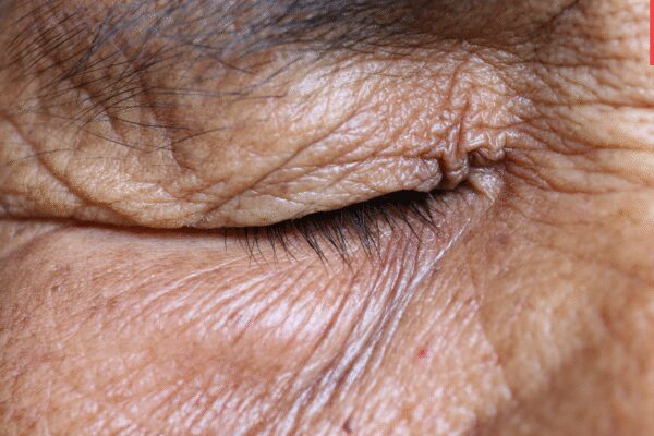 Which body parts start stretching first as we age?