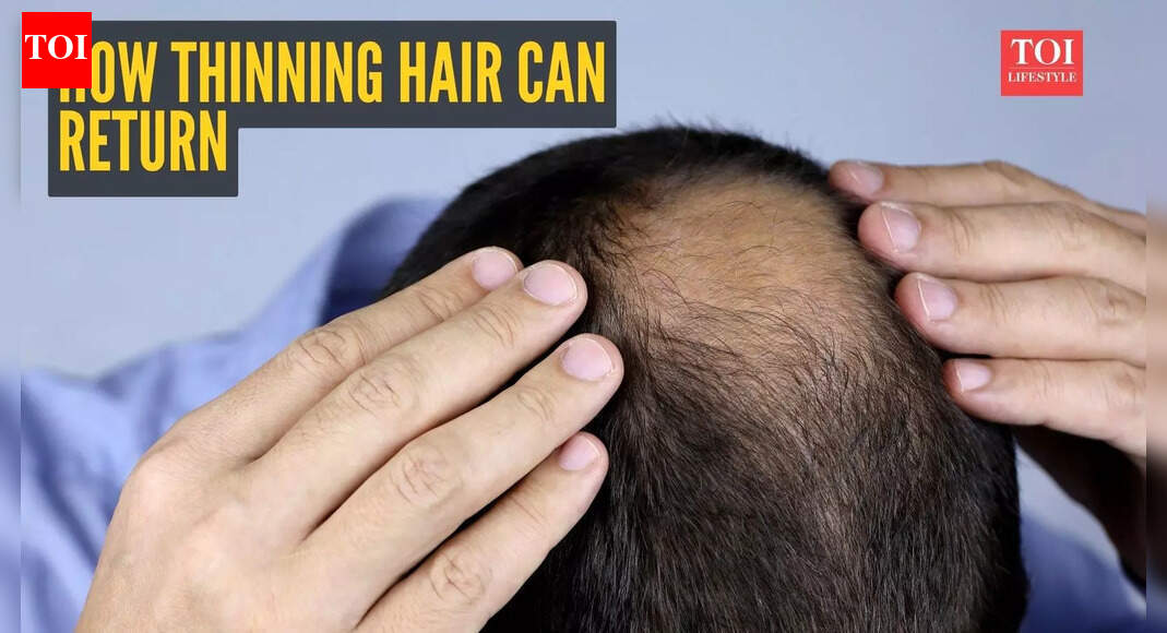 ‘Your hair can come back’: Doctor shares science-backed plan to restore thinning hair |