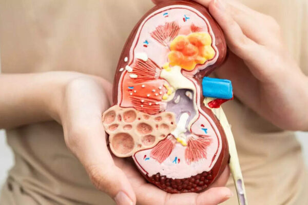 Reverse kidney damage naturally: Foods and habits for reducing inflammation and boosting metabolism |