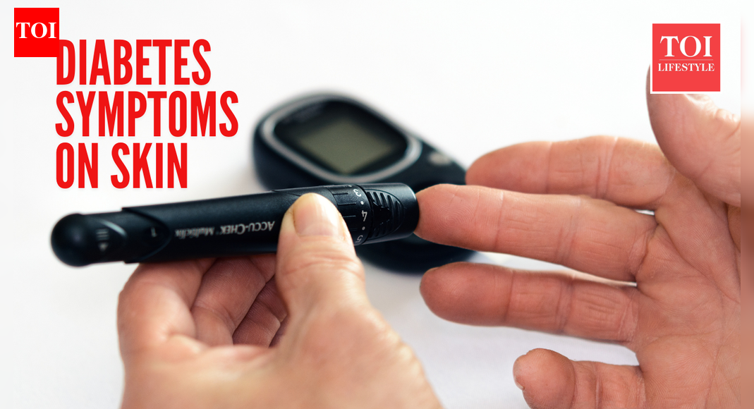 7 skin symptoms that may signal uncontrolled diabetes