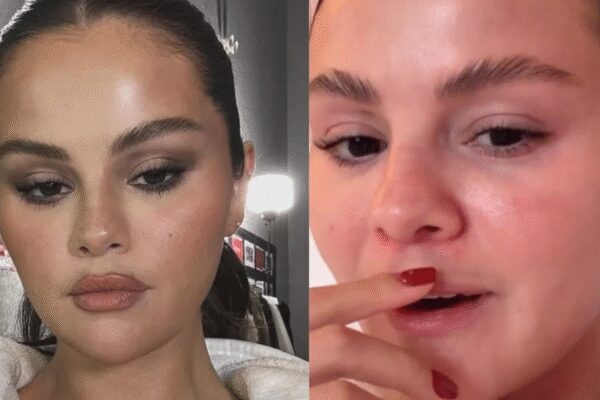 Selena Gomez opens up after facing comments about her ‘moustache’ on social media |