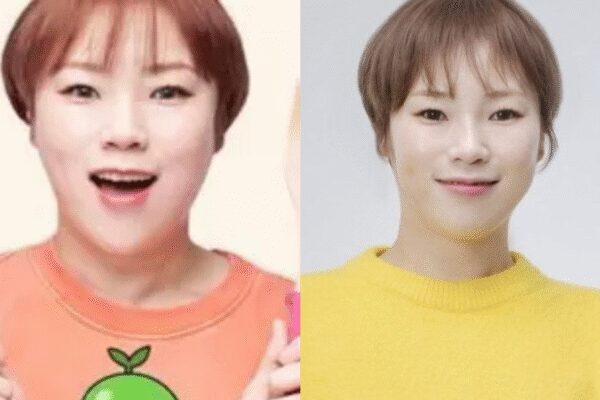 Who is Short Mouth Sun? Korean mukbang streamer quits streaming after admitting to illegal injection treatment