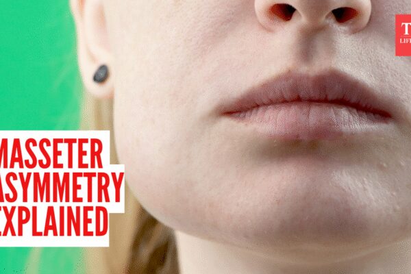 Masseter asymmetry explained: How chewing habits can subtly reshape your face