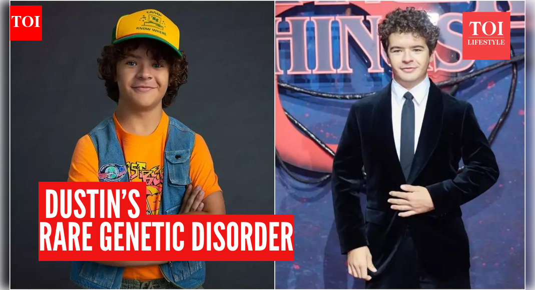 Stranger Things’ Dustin Henderson’s “toothless smile” is due to a rare condition: 10 facts to know about Cleidocranial Dysplasia