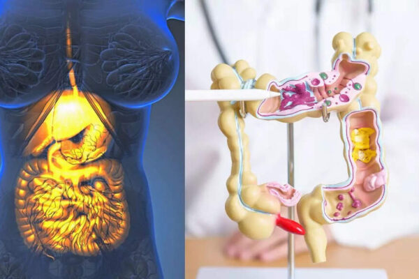 Gastroparesis vs. Irritable Bowel Syndrome: Symptoms, treatments and differences explained |