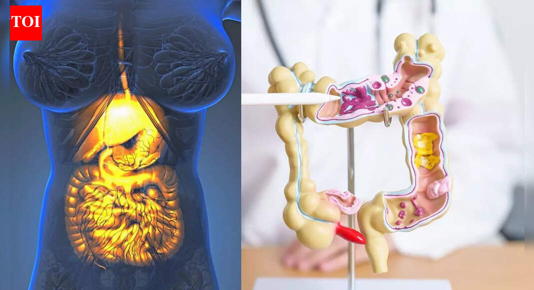 Gastroparesis vs. Irritable Bowel Syndrome: Symptoms, treatments and differences explained |