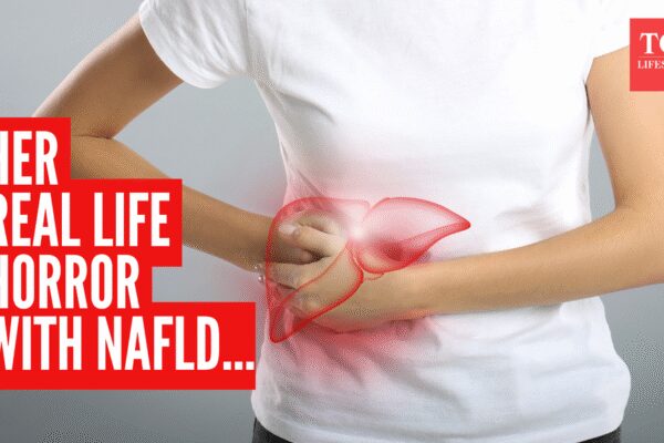 Severe non-alcoholic fatty liver disease: Doctor shares real story of how a woman missed her wedding and the symptoms she ignored