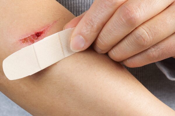 Girl shares why a small, unknown cut on public transport should not be ignored; shares personal experience of getting cut by blade